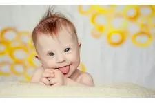 Down Sendromlu Bebek Özellikleri